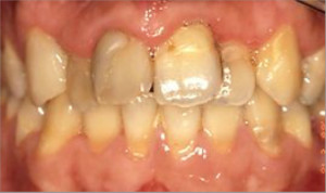 Ortodoncia y rehabilitaciones estéticas