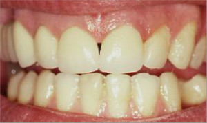 Ortodoncia y rehabilitaciones estéticas